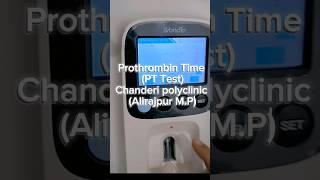 Prothrombin Time PT Test laboratory pathology bloodtests [upl. by Herman]