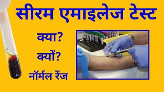 सीरम एमाइलेज टेस्ट Amylase test एमाइलेज़ की नॉर्मल रेंज amylase normal range [upl. by Byram]