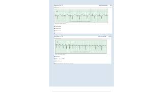 Relias Dysrhythmia Basic Test Answers 2023 Dysrhythmia – Basic A Questions and Answers [upl. by Eiggep]