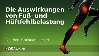 Knieprobleme vermeiden Die Bedeutung von Fuß und Hüftausrichtung  Dr Christian Larsen  QS24 [upl. by Lucie]