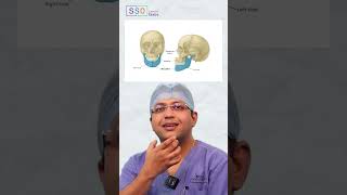 Jaw Removal and Reconstruction What You Need to Know  Dr Amit Chakraborty Mumbai [upl. by Eninnaej409]