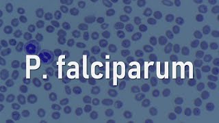 Plasmodium falciparum [upl. by Kerad]