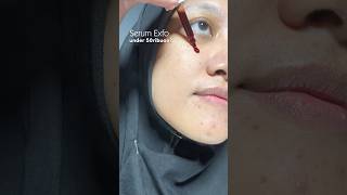 Review peeling serum Glad2glow skincare peelingsolution shorts [upl. by Eahsed]