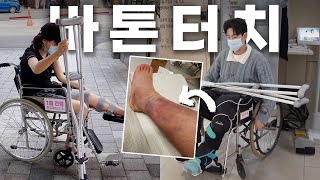 초비상🚨 남편 인대가 끊어졌습니다😨 금쪽같은 내 남편 ep1 [upl. by Ydneh]