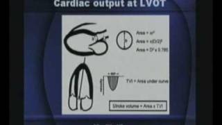 Basics Of Echocardiography Part2series2 [upl. by Sema]