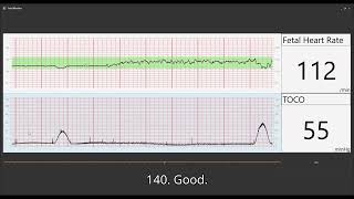 Fetal Heart Monitoring [upl. by Rebmac225]