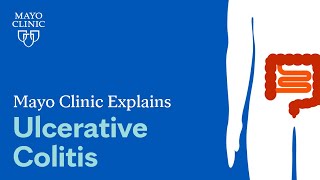 Mayo Clinic Explains Ulcerative Colitis [upl. by Thrasher]