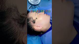 occulta SUO facelift xuhuongyoutube lamdep thongthainguyen [upl. by Georas]