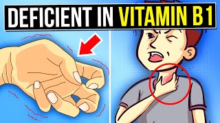 8 Warning Signs You’re DEFICIENT In VITAMIN B1 Thiamine [upl. by Saberhagen924]