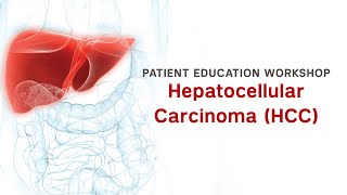 Workshop  Hepatocellular Carcinoma HCC [upl. by Dric]