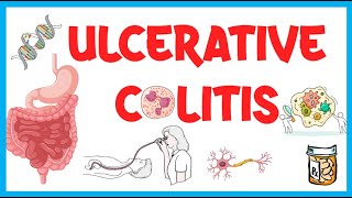 Ulcerative Colitis Causes Risk Factors Pathogenesis Clinical Presentation Diagnosis amp Treatment [upl. by Ahtnahc]