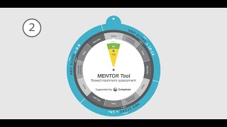 MENTOR Tool [upl. by Danella]