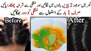 dandruff treatment at home  sar ki khushki door krny ka tarikahow to remove dandruff [upl. by Shugart]