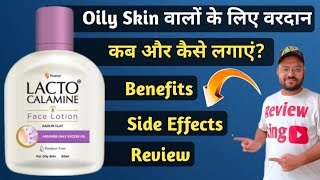 Lacto Calamine Face Lotion  Lacto Calamine Face Lotion How To Use  Lacto Calamine Lotion Review [upl. by Corene]