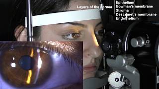 Ophthalmic Skills Series Part 15 [upl. by Yojal]