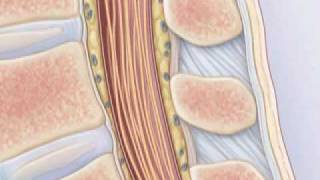 Comment pratiquer une ponction lombaire [upl. by Fogarty]