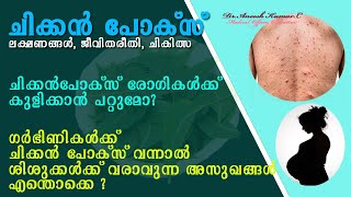 Chickenpox  Symptoms and Remedies  Ayurvedic treatment method of Chickenpox in Malayalam [upl. by Disraeli]