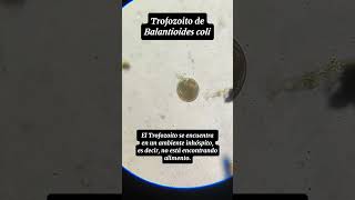 Trofozoito y Quiste de Balantioides coli Antiguamente conocido como Balantidium coli [upl. by Erin]