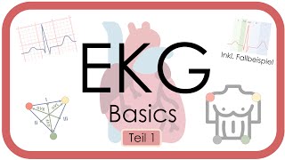 EKG Basics  Step by Step  Grundlagen Einthoven Frequenz Lagetyp PWelle QRS EKGKurs [upl. by Lienahs]