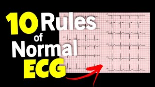 ECG  10 rules of Normal ECG  ECG interpretation • Daily Cardiology [upl. by Gothard]