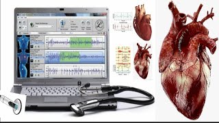 MIDSYSTOLIC CLICK  APEX  HEART SOUNDS  AUSCULTATION  MURMUR [upl. by Soracco]