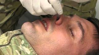 Inserting an NPA Nasopharyngeal Airway [upl. by Lindy]