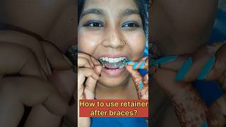 How to use retainer after braces  Retainer after braces treatment  Braces treatment  Sitamarhi [upl. by Appleton198]