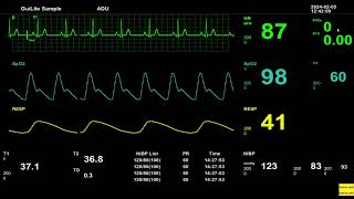 Patient Monitor NSR Cardiac Monitor [upl. by Limber]