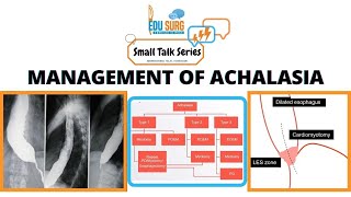 Achalasia cardia management [upl. by Griggs]