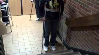 3 Point Gait Crutch Ambulation on Stairs [upl. by Lrub]