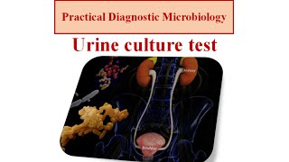 Urine culture test  micro lab 2 [upl. by Eelyma]