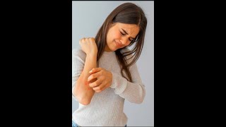 Remedies For Itchy Skin Quick Cure For Skin Rashes [upl. by Kling554]