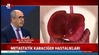 Metastatik Karaciğer Hastalıkları  Prof Dr Kamil Yalçın Polat [upl. by Niggem]