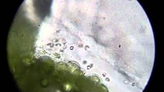 Ceratopteris gametophytes and sperm [upl. by Geraldina414]