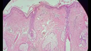 Histology of thin skin slide identification and explanation [upl. by Jackson]