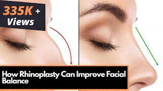 How Rhinoplasty Can Improve Facial Balance  Dr Debraj Shome [upl. by Boni]