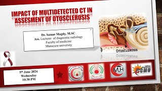 Impact of MultiDetector CT scan inassessment of otosclerosis by Dr Samar Magdy MSc [upl. by Amikehs959]