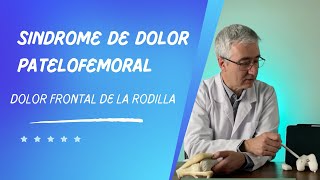 Sindrome de Dolor Patelofemoral ¿porqué se produce [upl. by Amaryl]